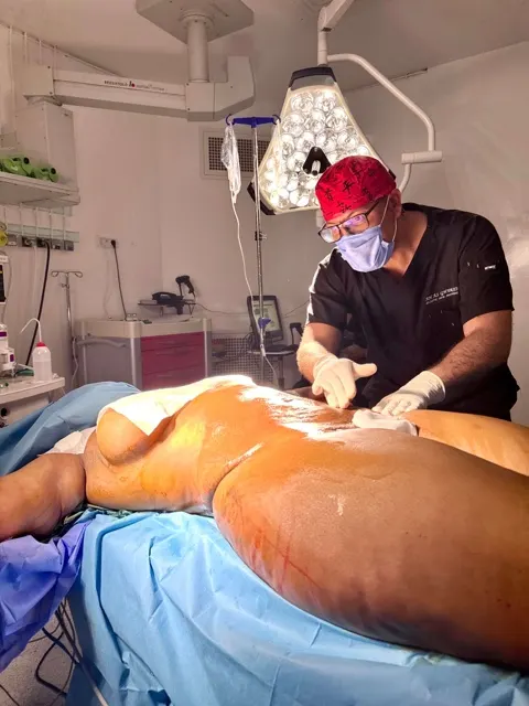 Shooting photo de chirurgie esthétique au bloc opératoire, geste du chirurgien en gros plan
